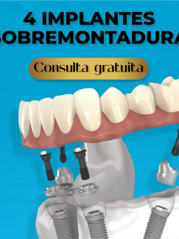 Professional teeth whitening at Kendall Breeze Dental Centers