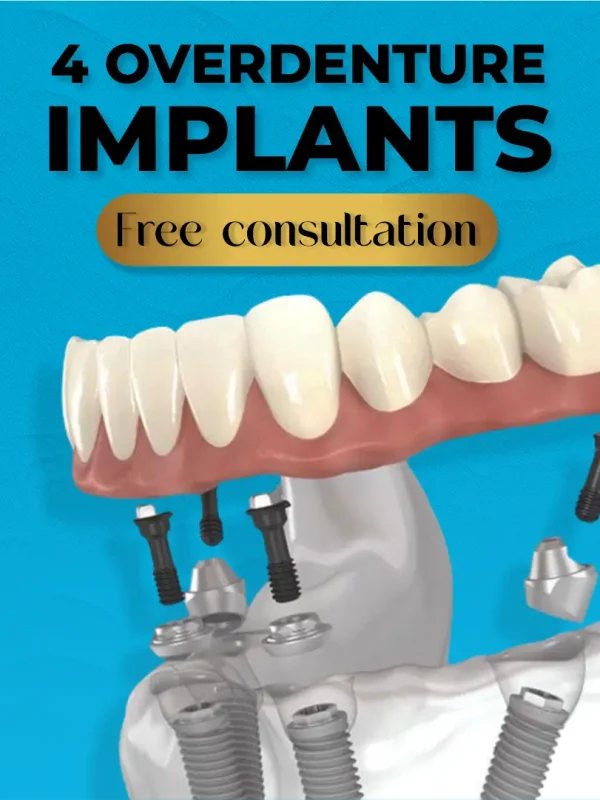 Professional teeth whitening at Kendall Breeze Dental Centers