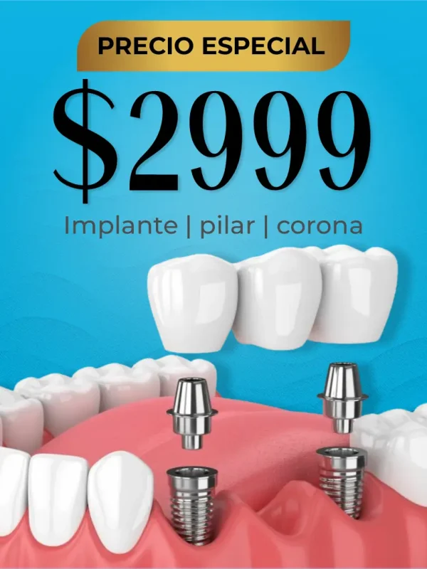 Precio-especial-Español